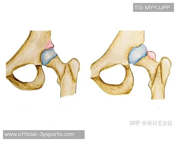 篮球髋的训练技巧与运动损伤预防方法全面解析